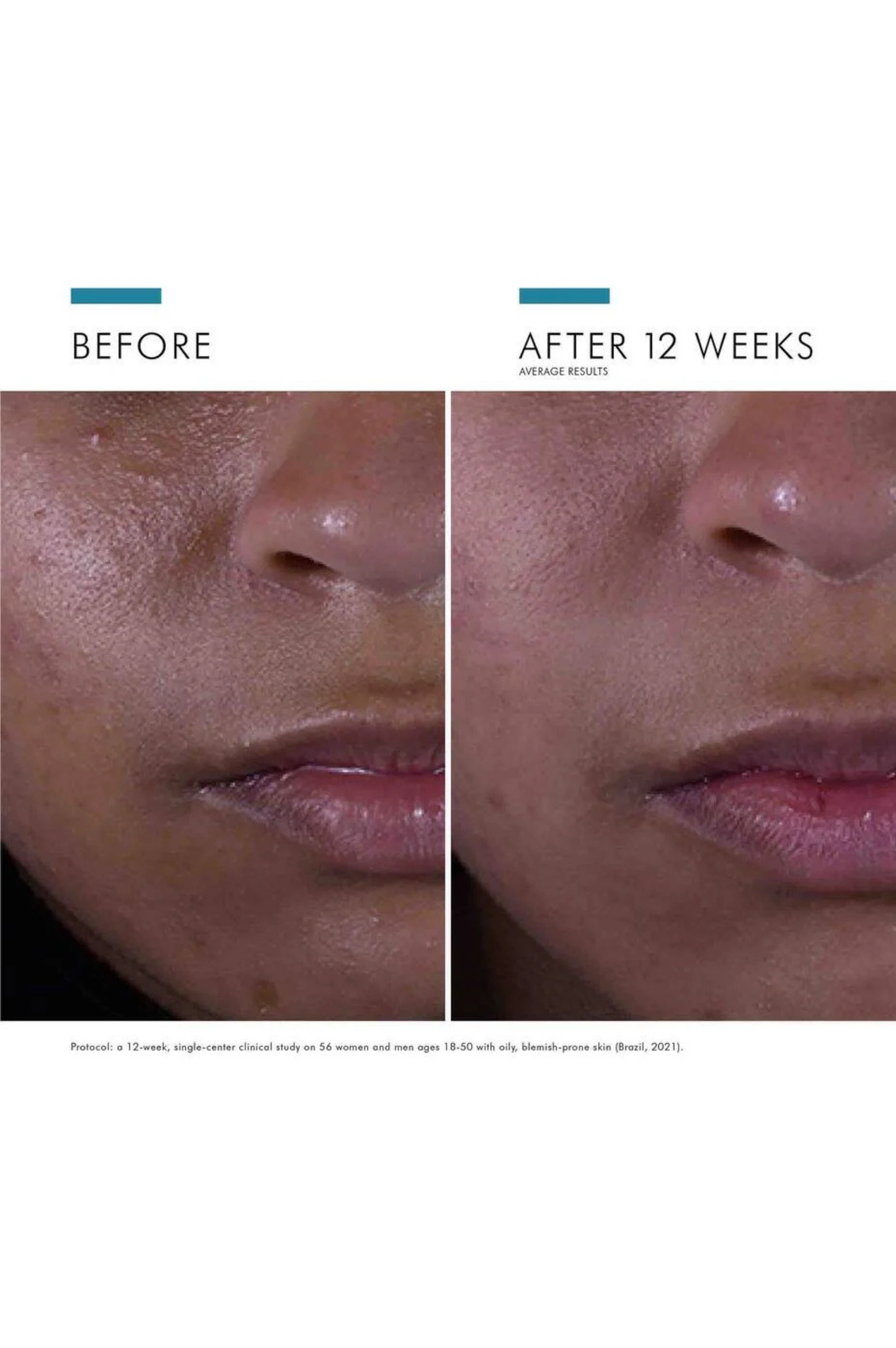 Silymarin CF