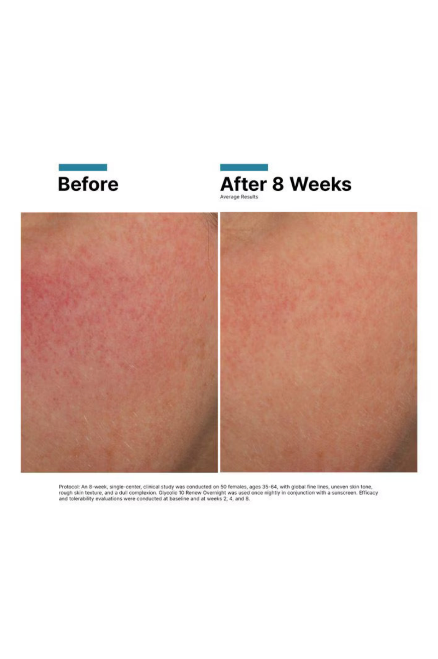 Glycolic 10 Renew Overnight
