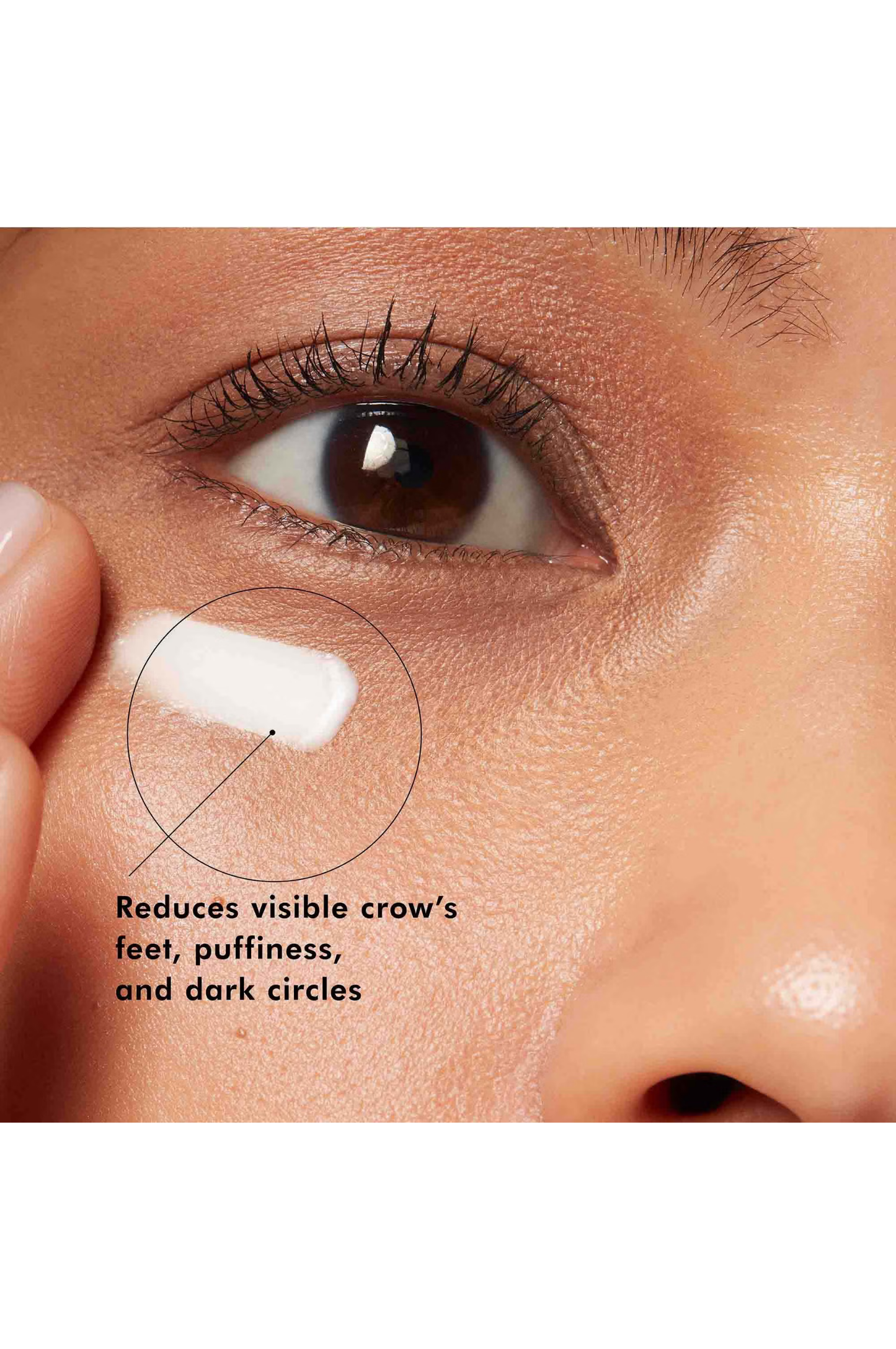 A.G.E Advanced Eye