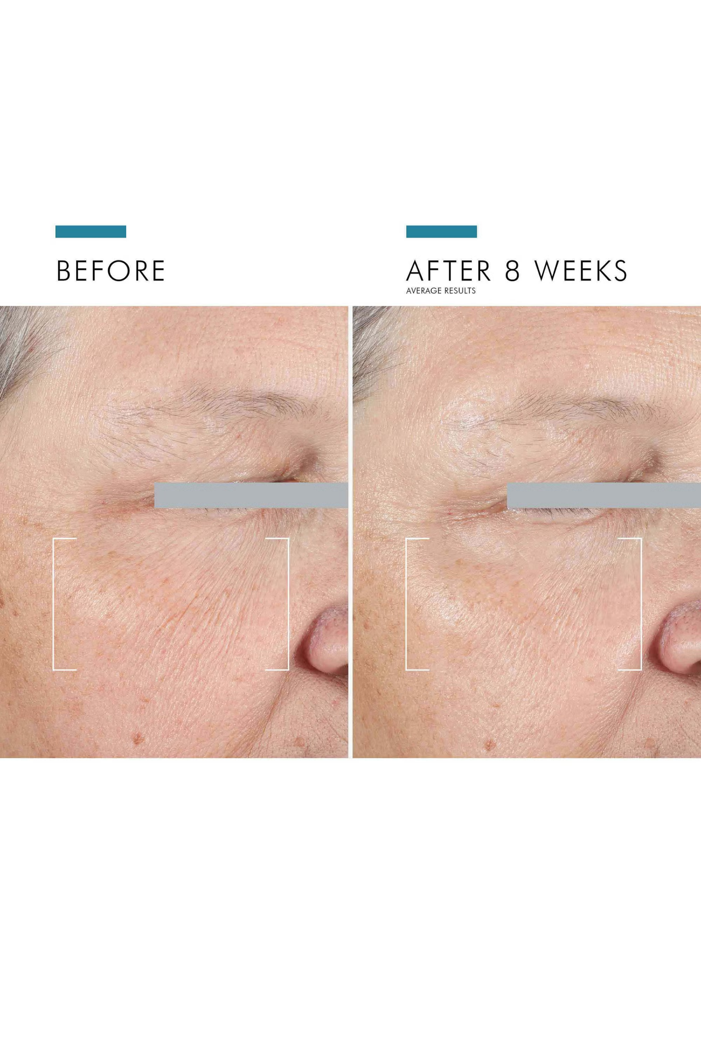 A.G.E Advanced Eye