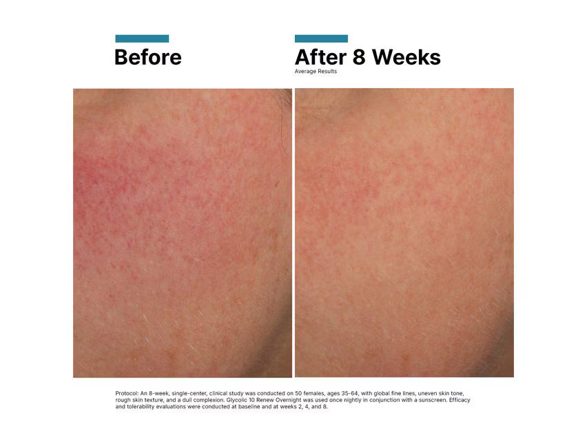 Glycolic 10 Renew Overnight