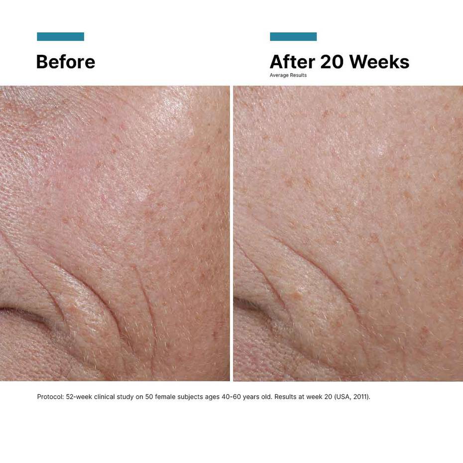 CE Ferulic
