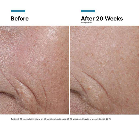CE Ferulic