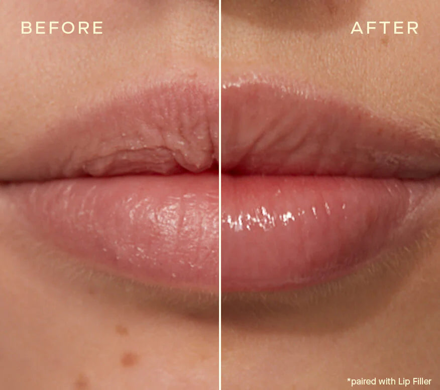 The Lip Plumping and Enhancing Duo