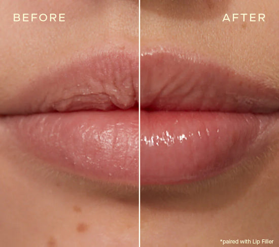 The Lip Plumping and Enhancing Duo