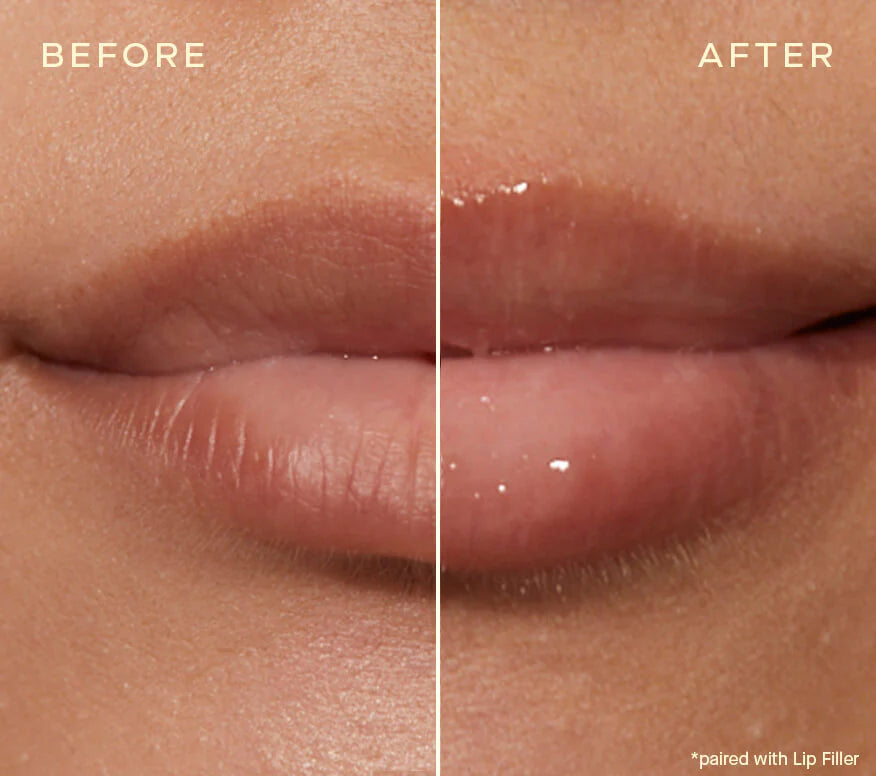 The Lip Plumping and Enhancing Duo