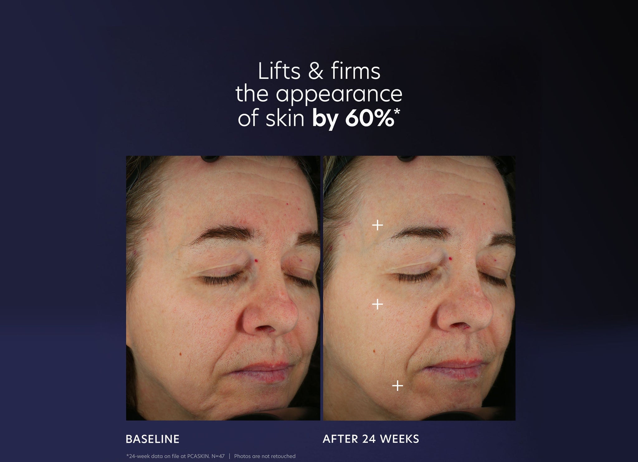 Pro-Max Age Renewal Serum