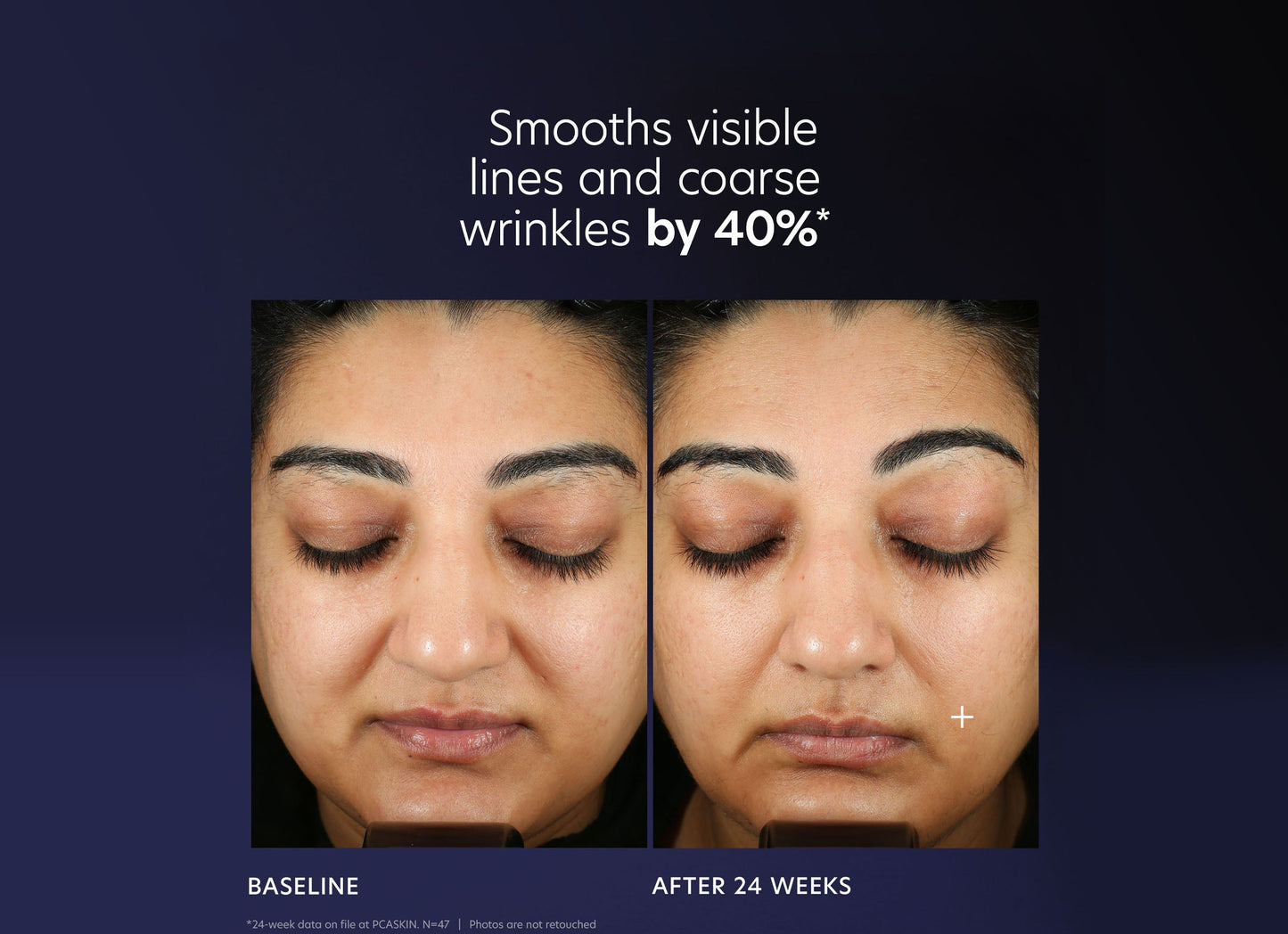 Pro-Max Age Renewal Serum