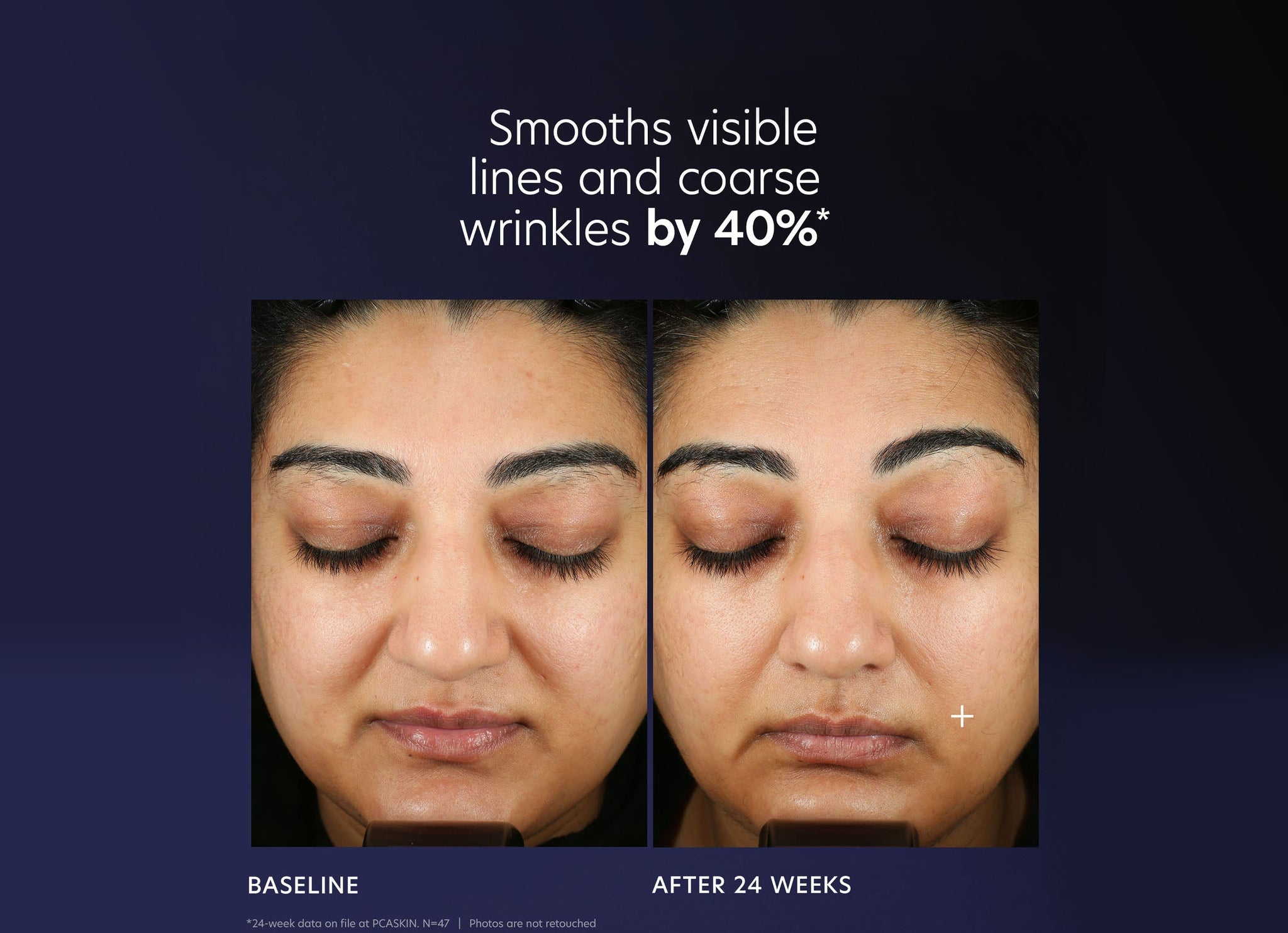 Pro-Max Age Renewal Serum