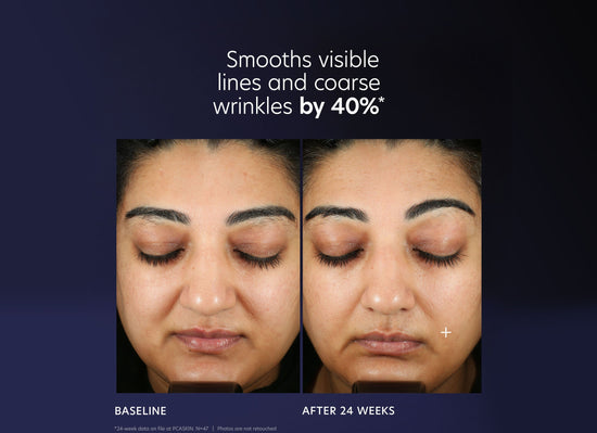 Pro-Max Age Renewal Serum