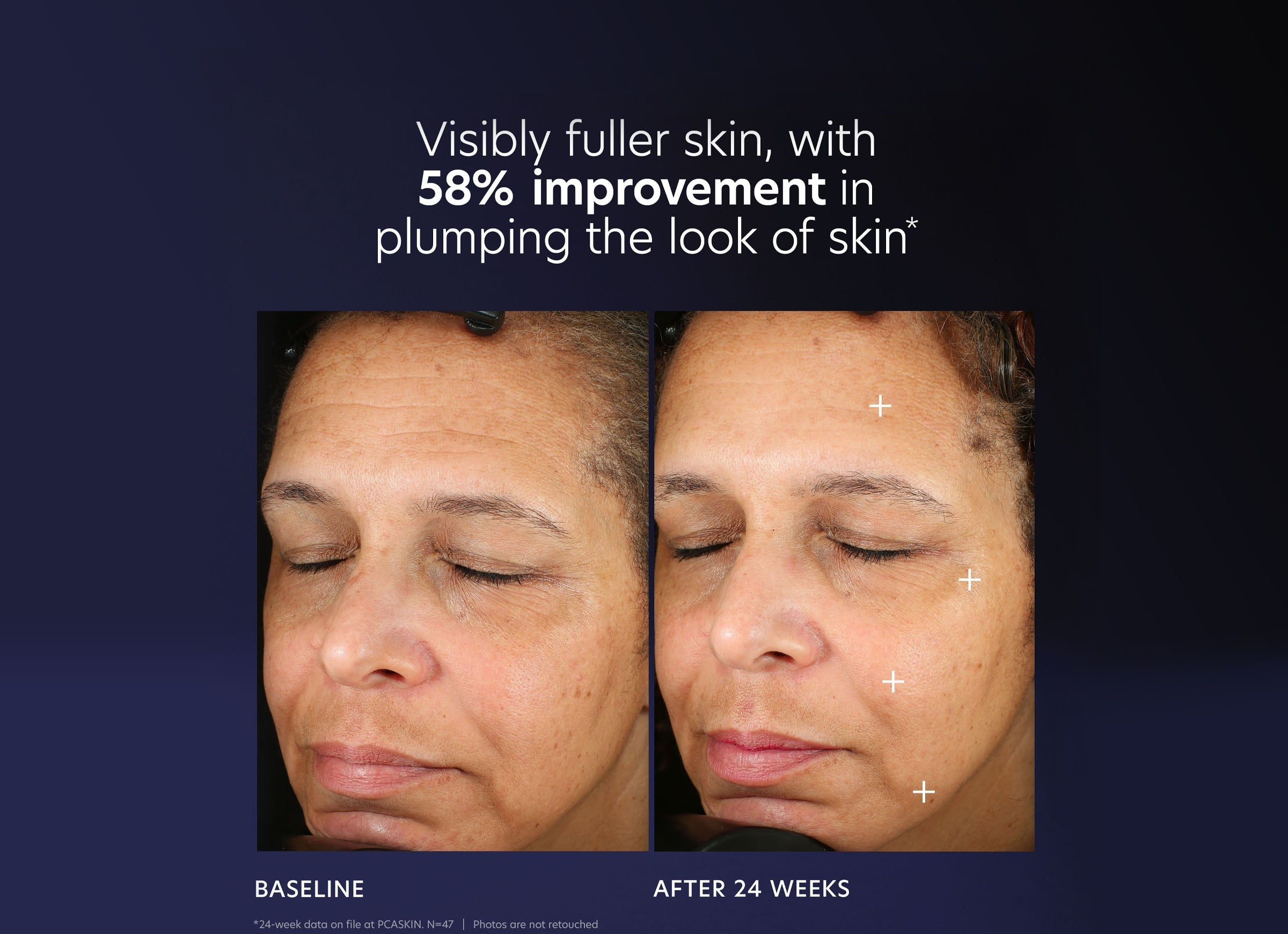 Pro-Max Age Renewal Serum