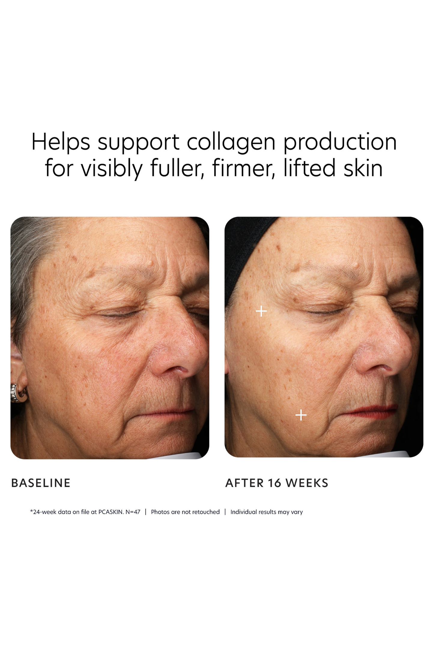 MGF Age Renewal Cream