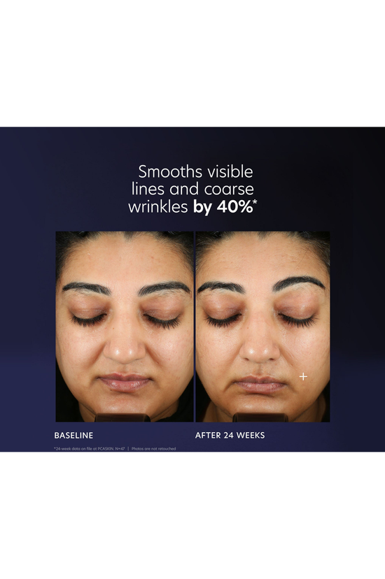 Pro-Max Age Renewal Serum