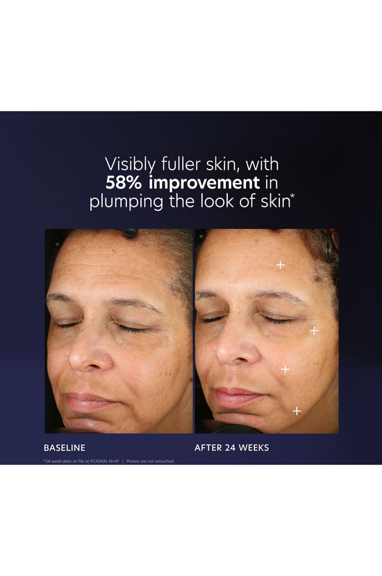 Pro-Max Age Renewal Serum