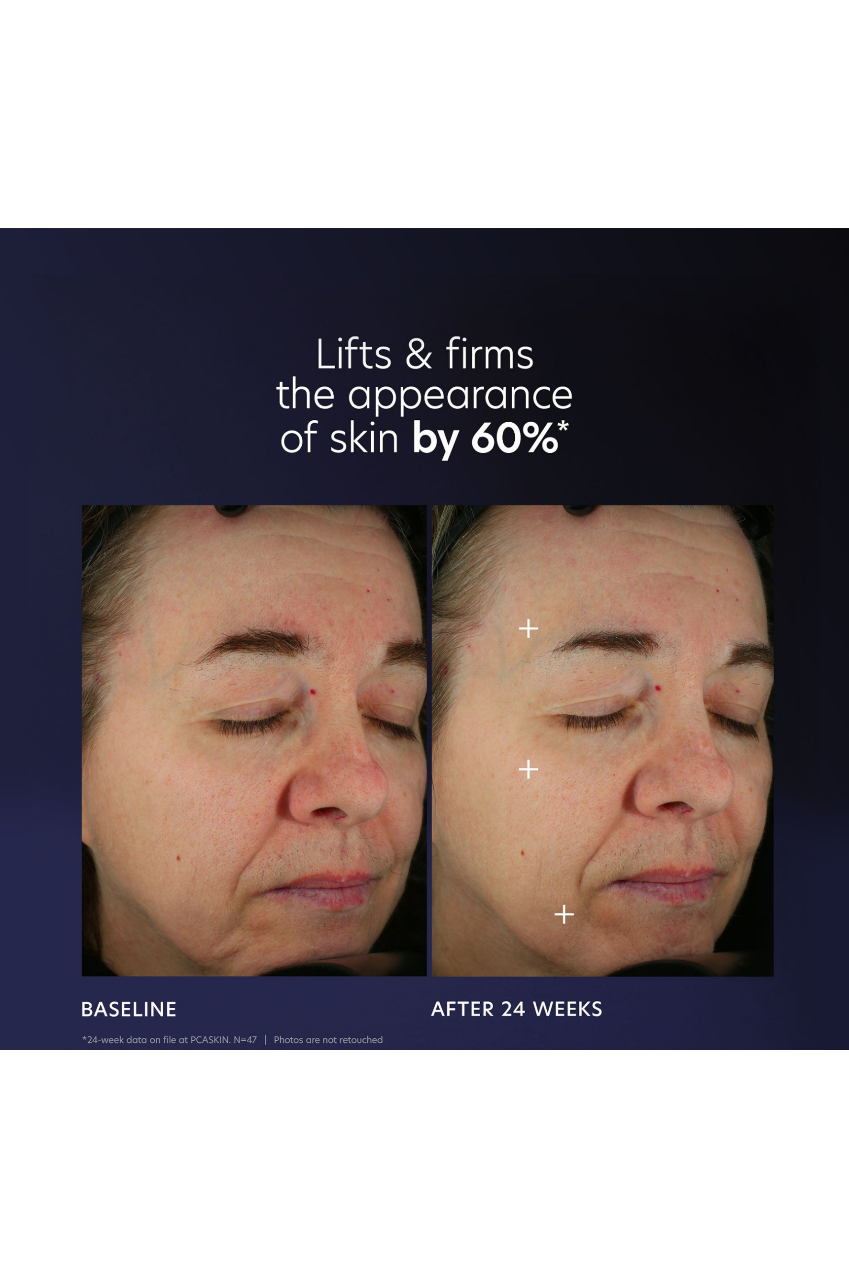 Pro-Max Age Renewal Serum