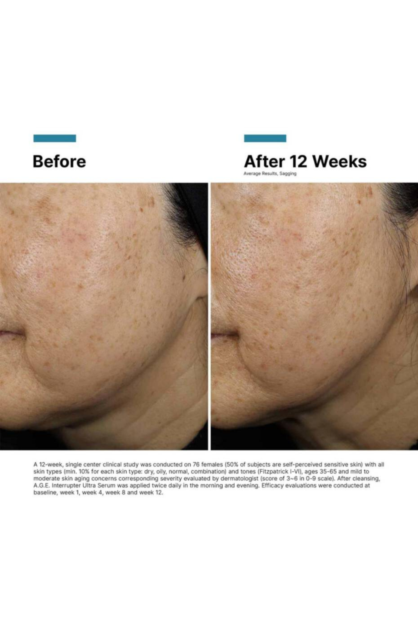 A.G.E Interrupter Ultra Serum