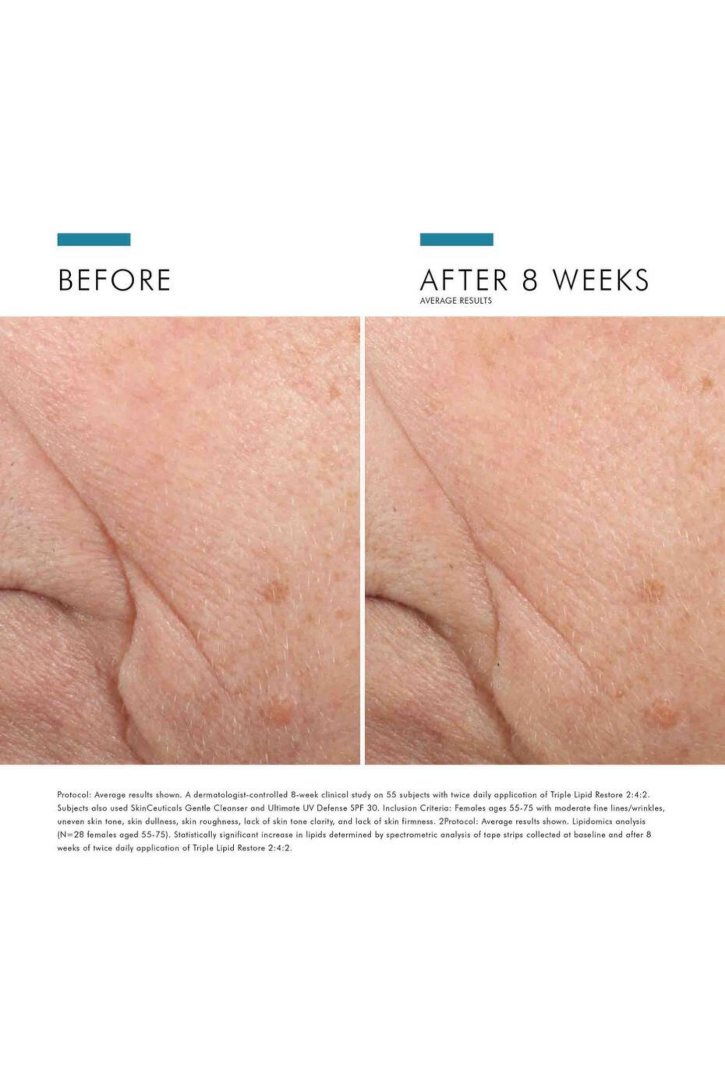 Triple Lipid Restore 2:4:2