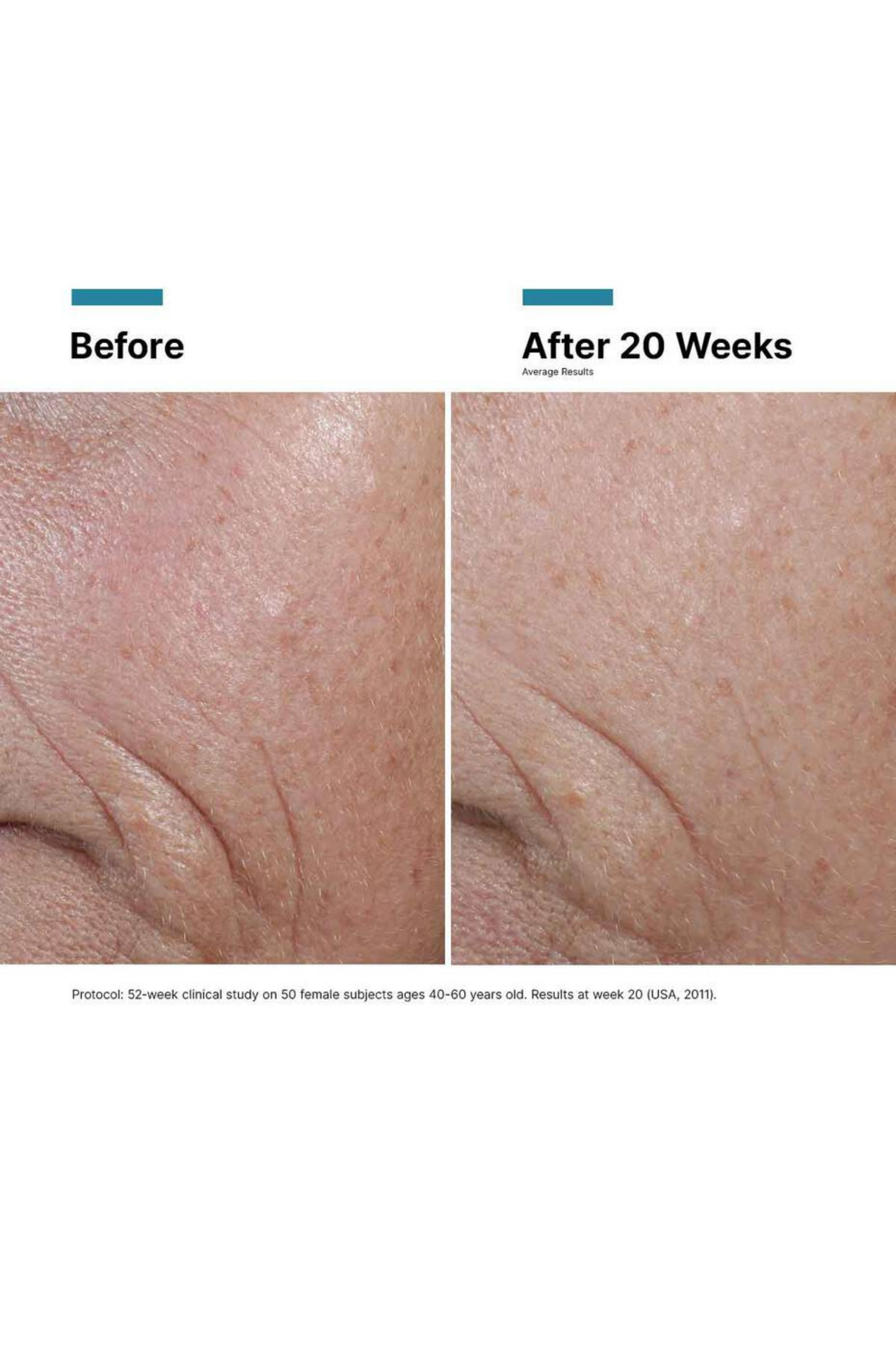 C E Ferulic