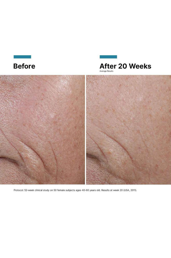 C E Ferulic