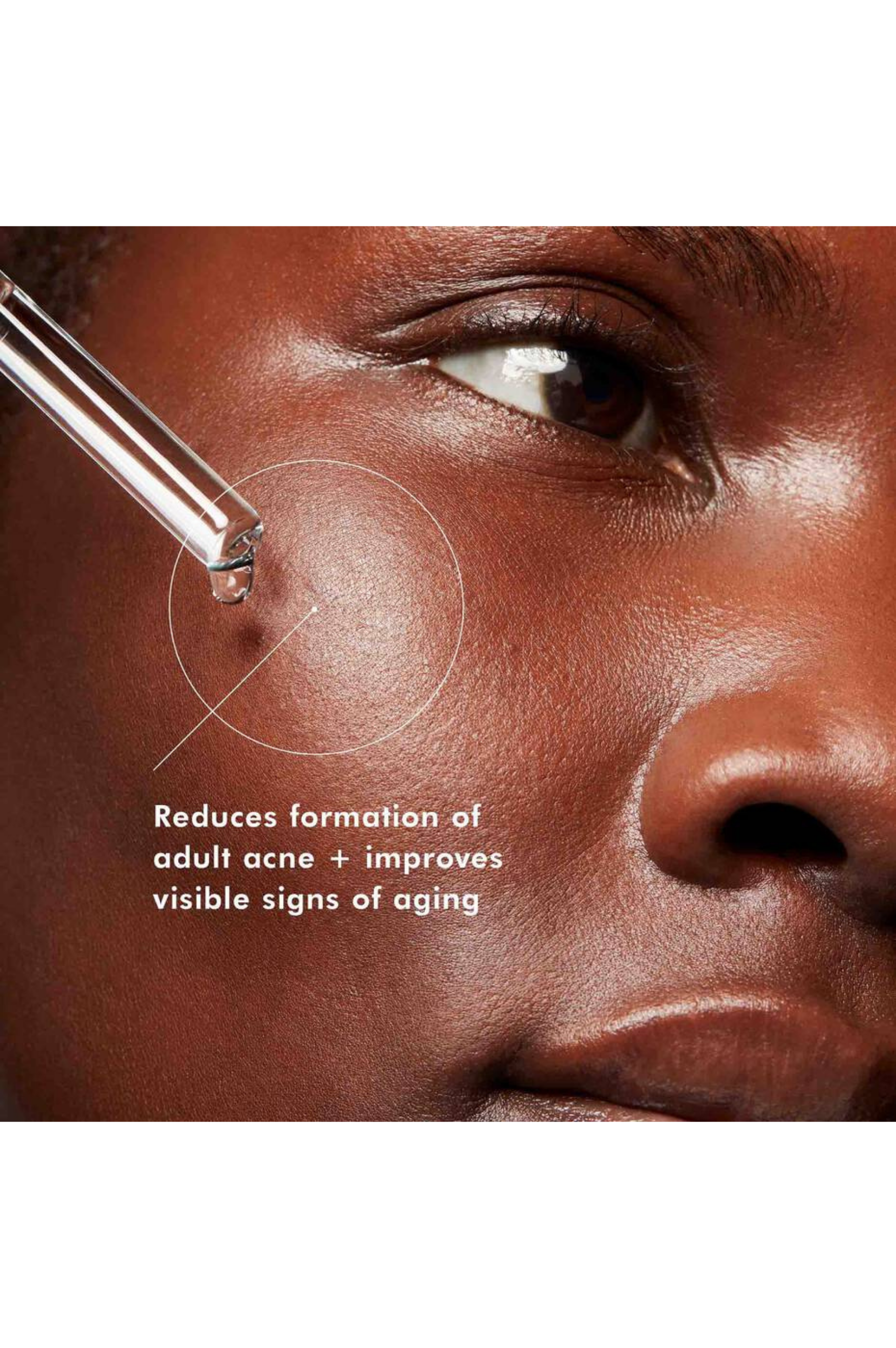 Blemish + Age Defense