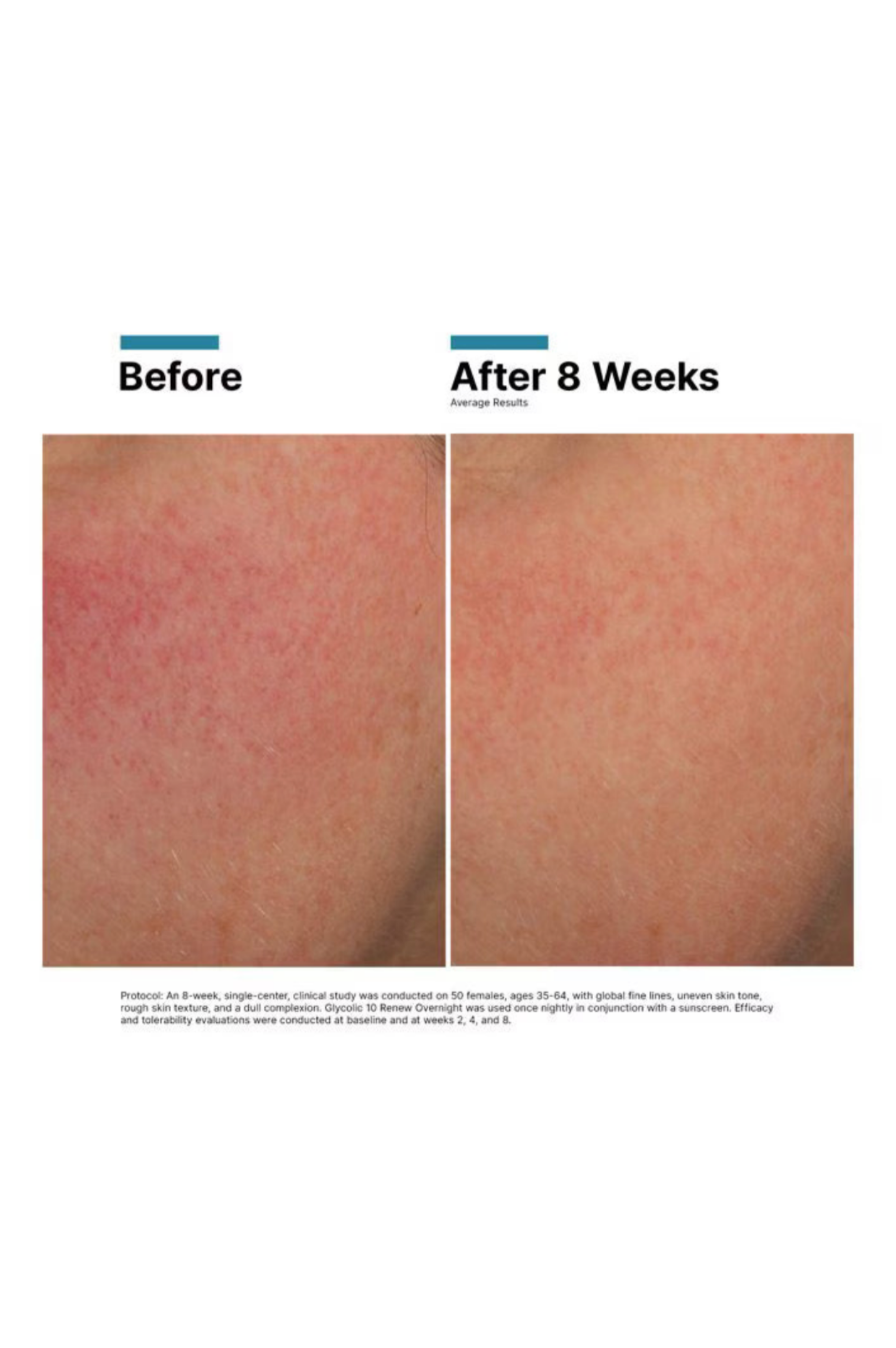 Glycolic 10 Renew Overnight
