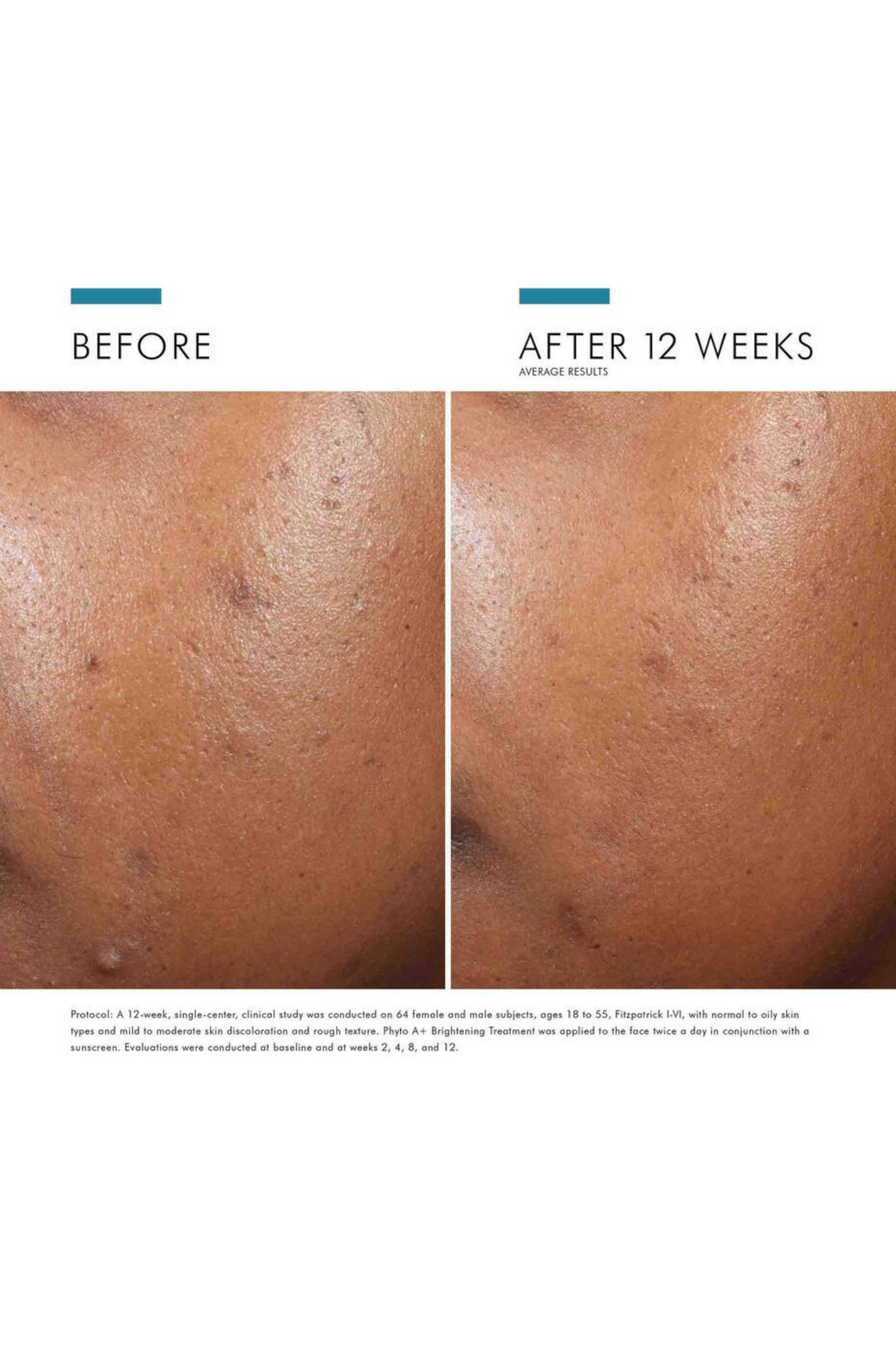 Phyto A+ Brightening Treatment