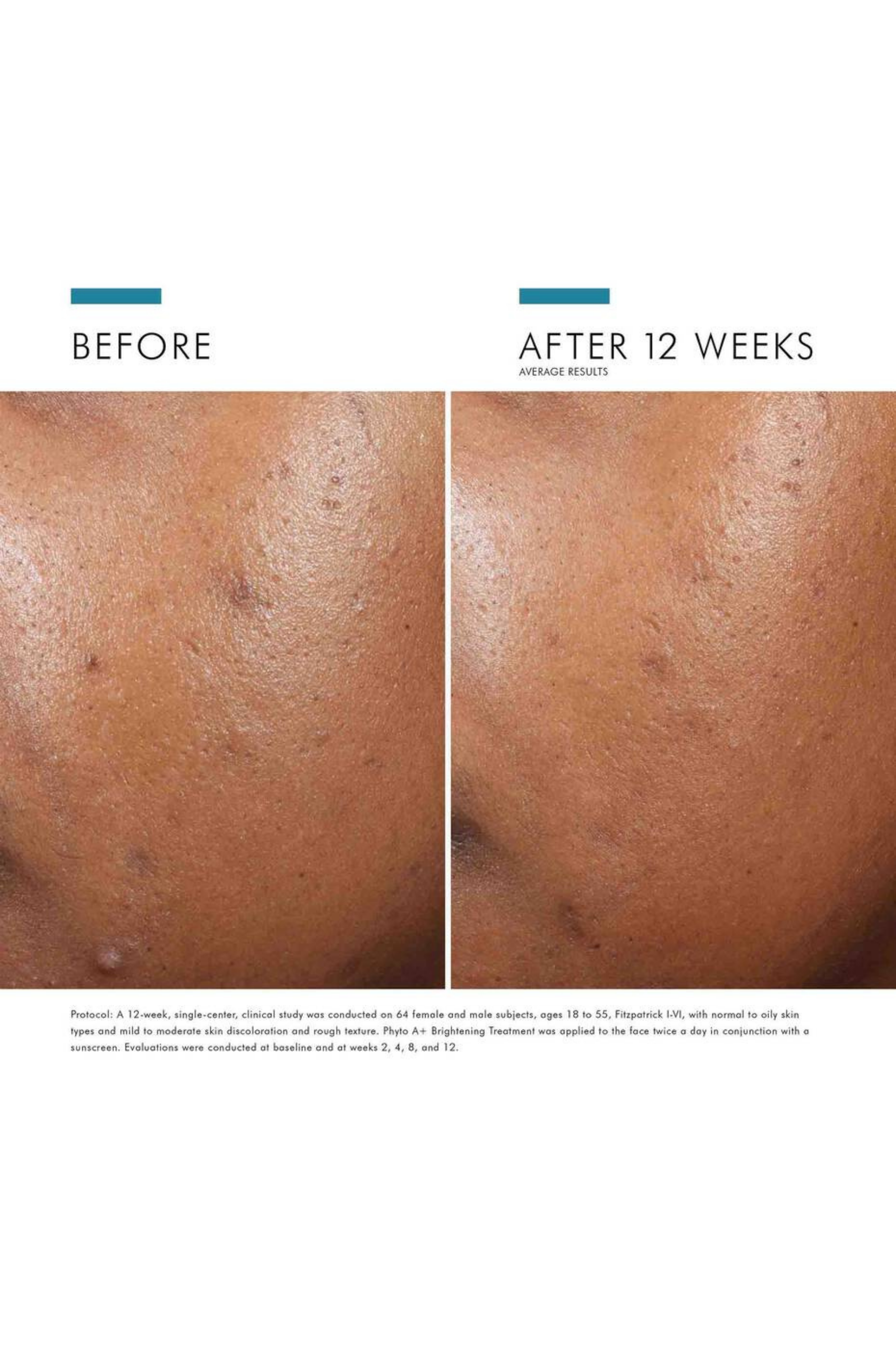 Phyto A+ Brightening Treatment