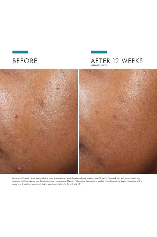 Phyto A+ Brightening Treatment