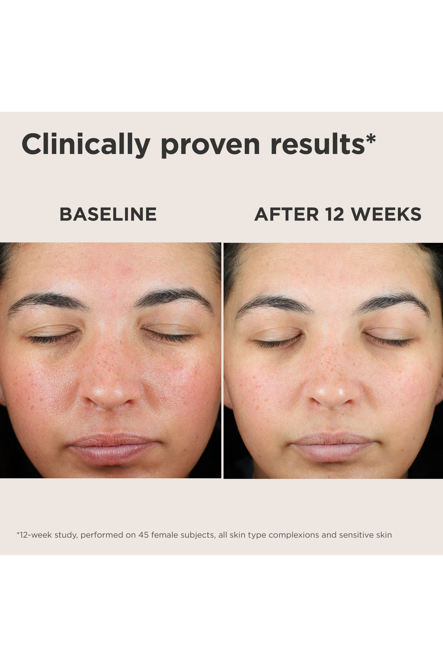UV Skin Recovery Green SPF 50