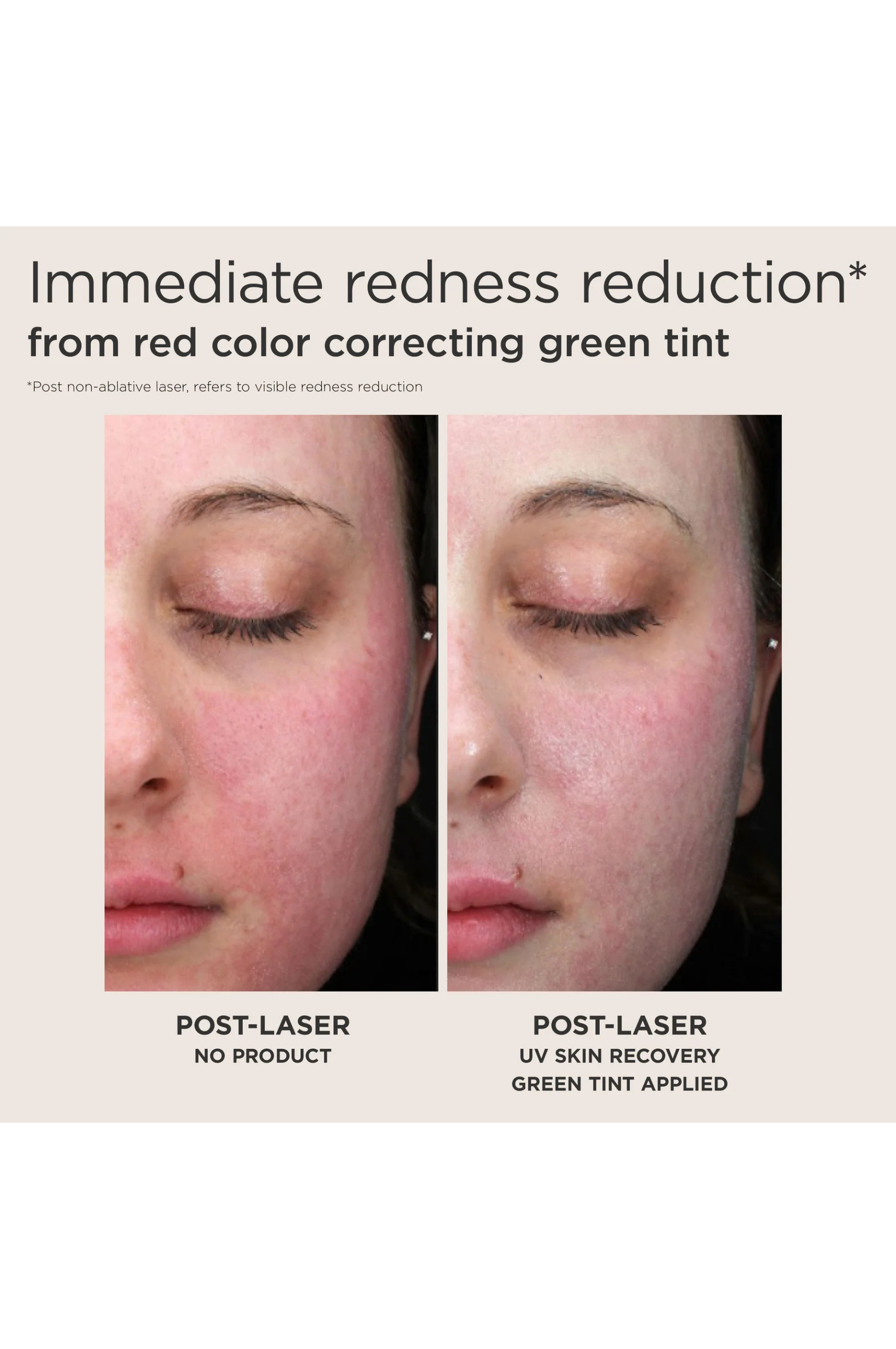 UV Skin Recovery Green SPF 50