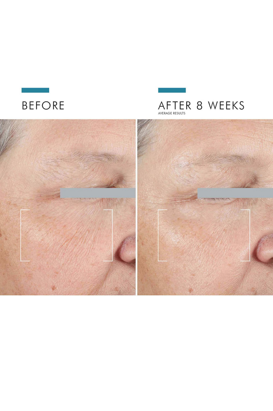 A.G.E Advanced Eye